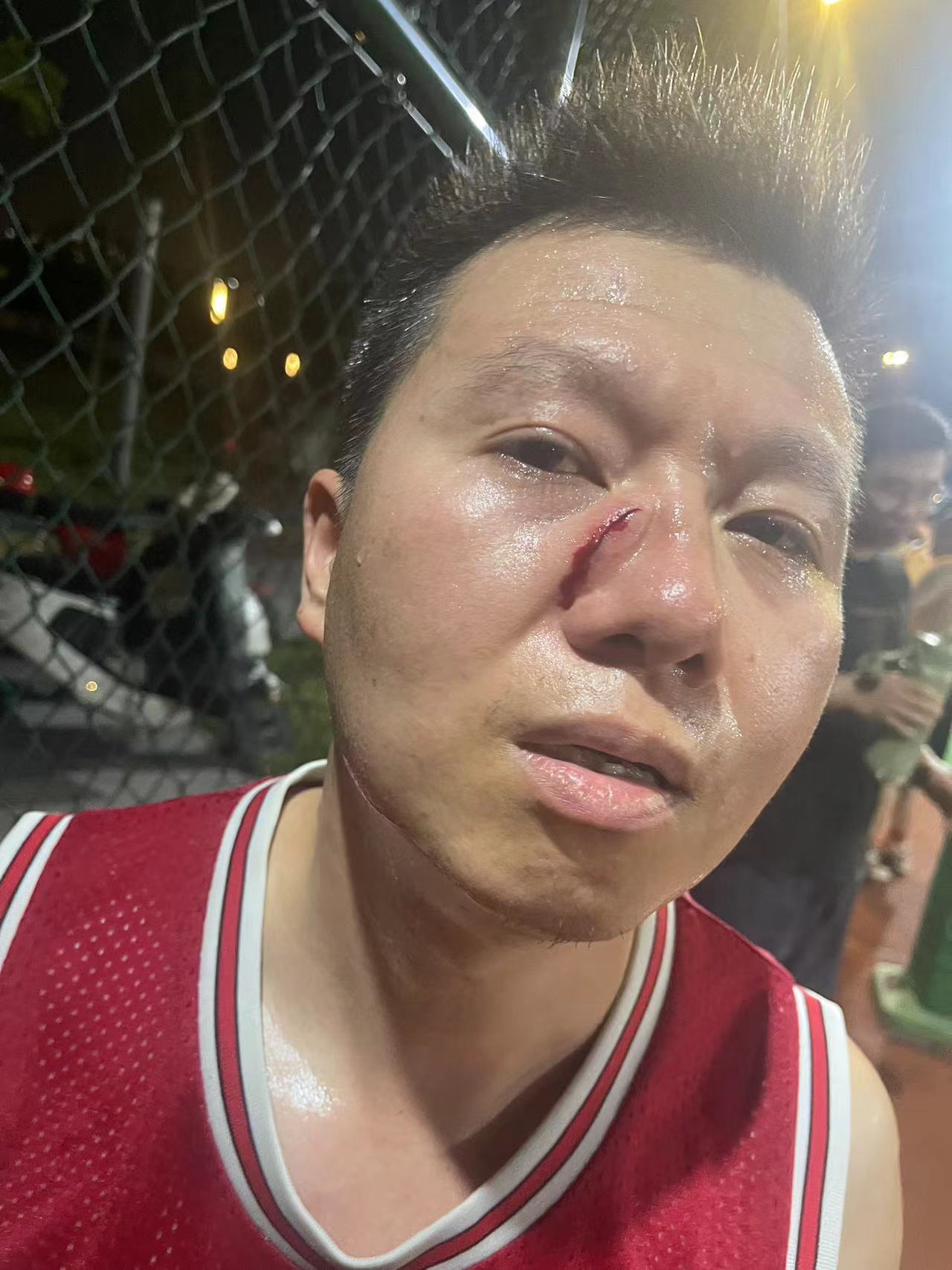 篮球明星球员受伤,球队战绩受到影响 篮球明星球员受伤,球队战绩受到影响